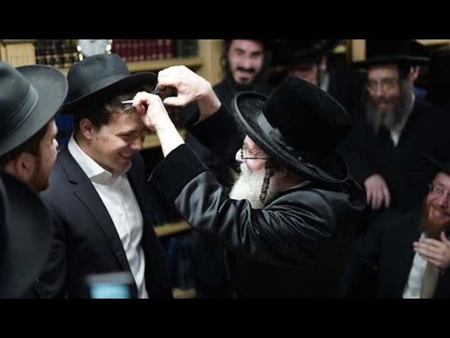 עֵשָׂו אָחִי אִישׁ שָׂעִר וְאָנֹכִי אִישׁ חָלָק • אדמו"ר מסקולען מאנסי גזר בלורית משני בחורים צדיקים