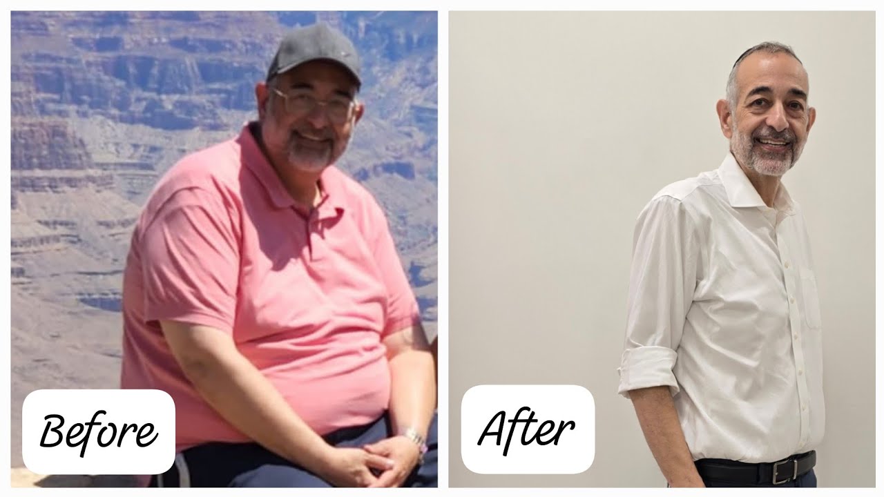 From 387 lbs to 189 lbs —after 3 failed surgeries, I finally found success w/shots through Dr. Peltz